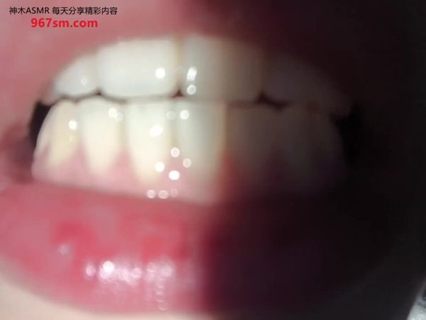 菜菜cyl不好吃 口腔检查